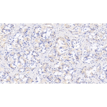 Interleukin 29 (IL29) Human Monoclonal Antibody