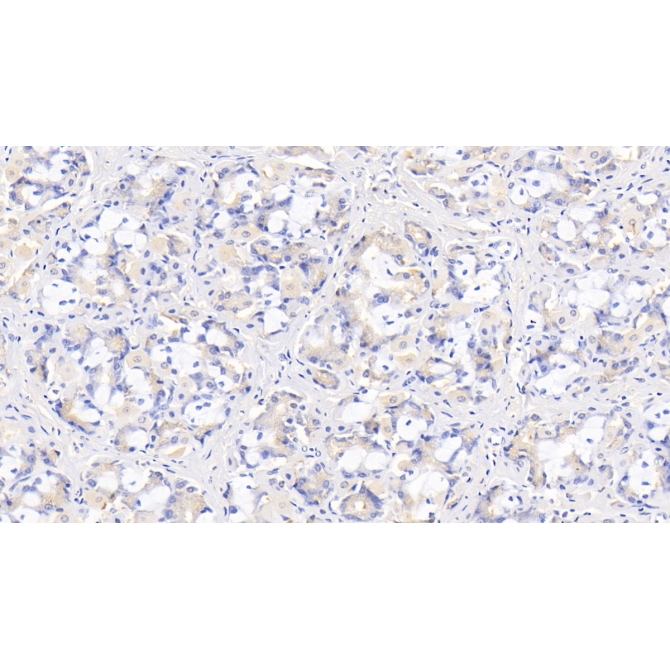 Interleukin 29 (IL29) Human Monoclonal Antibody