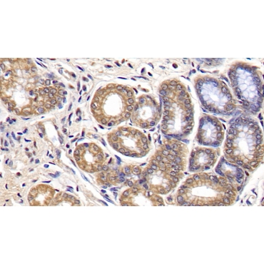 Interleukin 29 (IL29) Human Monoclonal Antibody