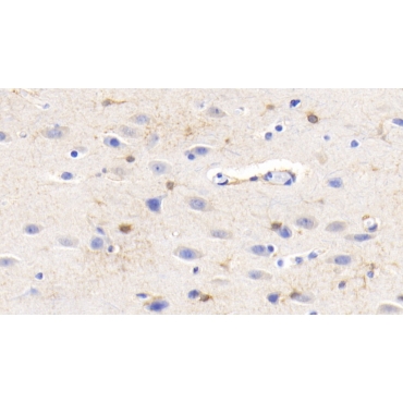 Creatine Kinase B (CK-BB) Human Monoclonal Antibody