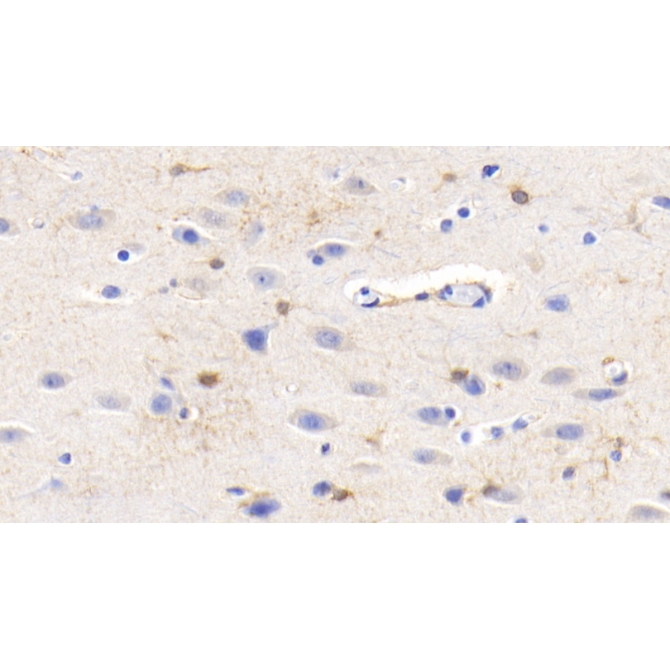 Creatine Kinase B (CK-BB) Human Monoclonal Antibody