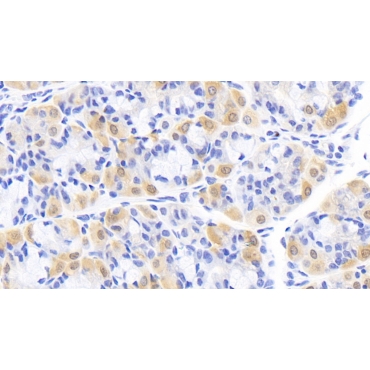 Creatine Kinase B (CK-BB) Human Monoclonal Antibody