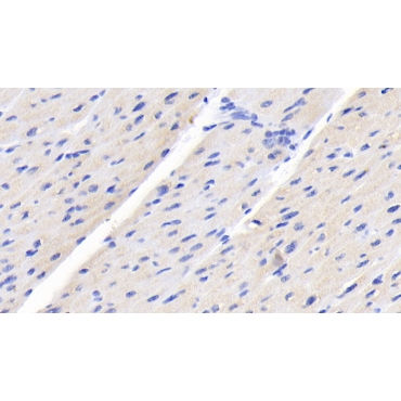 Creatine Kinase B (CK-BB) Human Monoclonal Antibody