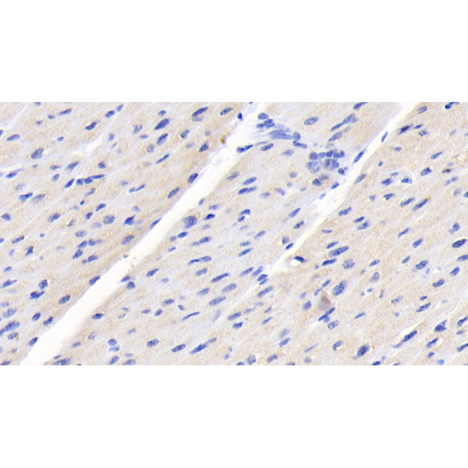 Creatine Kinase B (CK-BB) Human Monoclonal Antibody