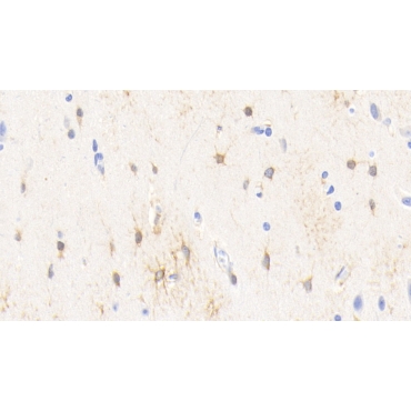 Creatine Kinase B (CK-BB) Human Monoclonal Antibody