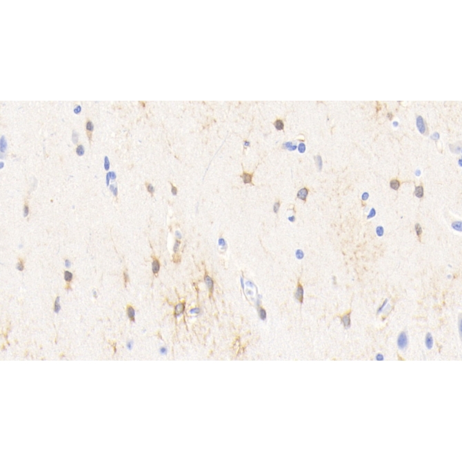 Creatine Kinase B (CK-BB) Human Monoclonal Antibody