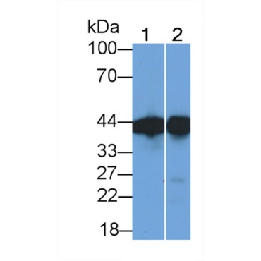 Creatine Kinase B (CK-BB) Human Monoclonal Antibody