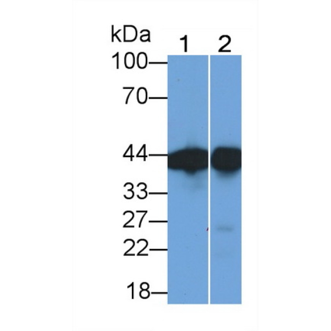 Creatine Kinase B (CK-BB) Human Monoclonal Antibody