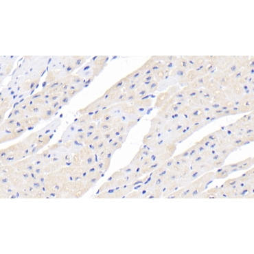 Creatine Kinase B (CK-BB) Human Monoclonal Antibody