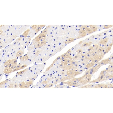 Creatine Kinase B (CK-BB) Human Monoclonal Antibody