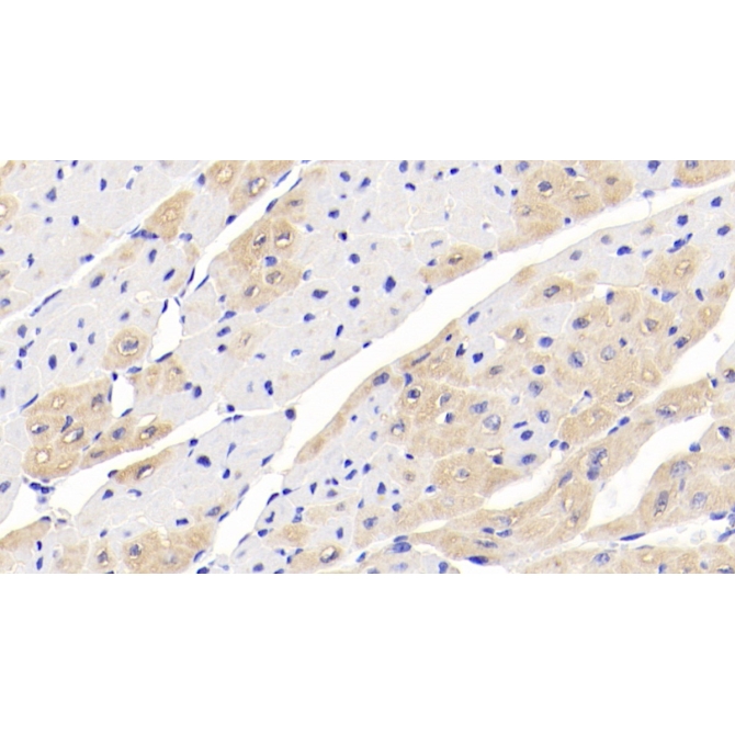 Creatine Kinase B (CK-BB) Human Monoclonal Antibody