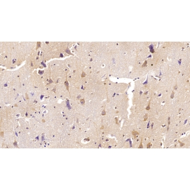 Interleukin 22 (IL22) Human Monoclonal Antibody