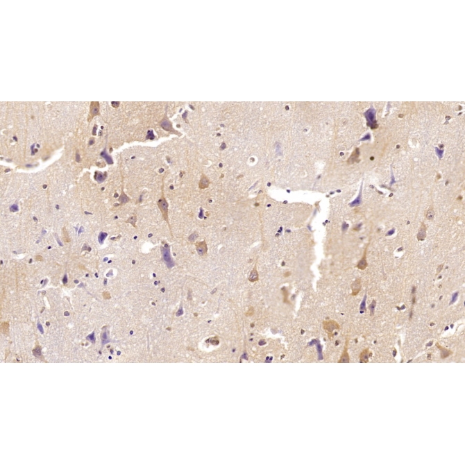 Interleukin 22 (IL22) Human Monoclonal Antibody