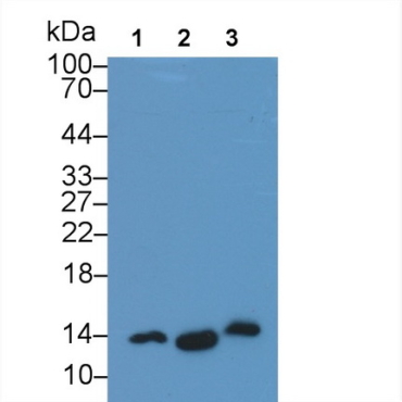 Interleukin 22 (IL22) Human Monoclonal Antibody