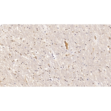 Interleukin 22 (IL22) Human Monoclonal Antibody