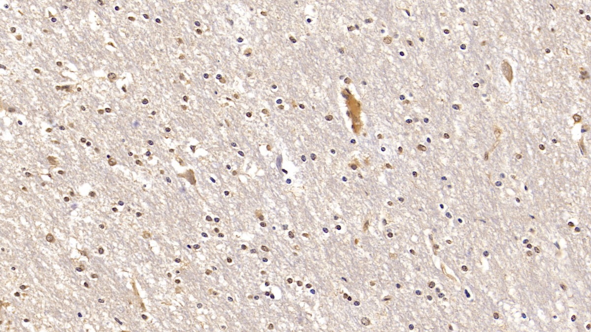 Interleukin 22 (IL22) Human Monoclonal Antibody