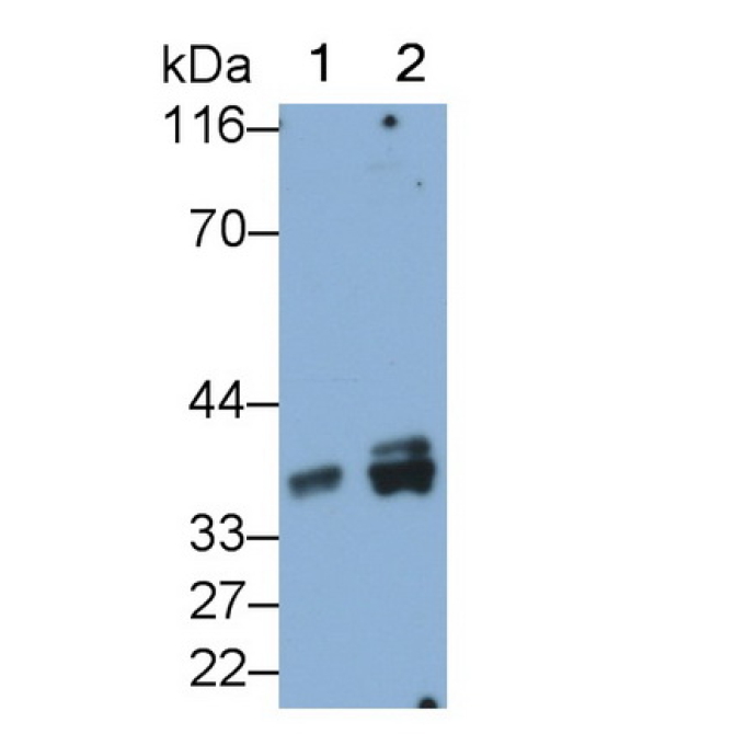 Growth Differentiation Factor 15 (GDF15) Human Monoclonal Antibody