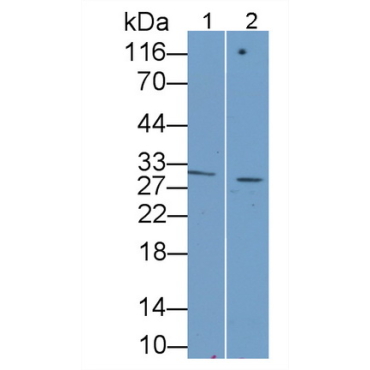 Growth Differentiation Factor 15 (GDF15) Human Monoclonal Antibody