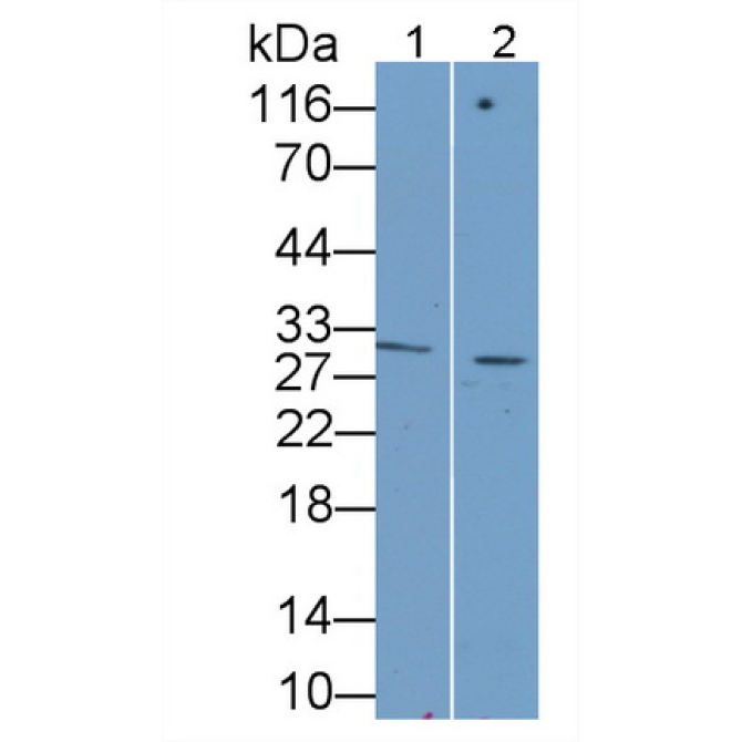 Growth Differentiation Factor 15 (GDF15) Human Monoclonal Antibody