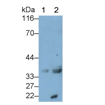 Growth Differentiation Factor 15 (GDF15) Human Monoclonal Antibody