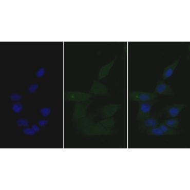 Growth Differentiation Factor 15 (GDF15) Human Monoclonal Antibody