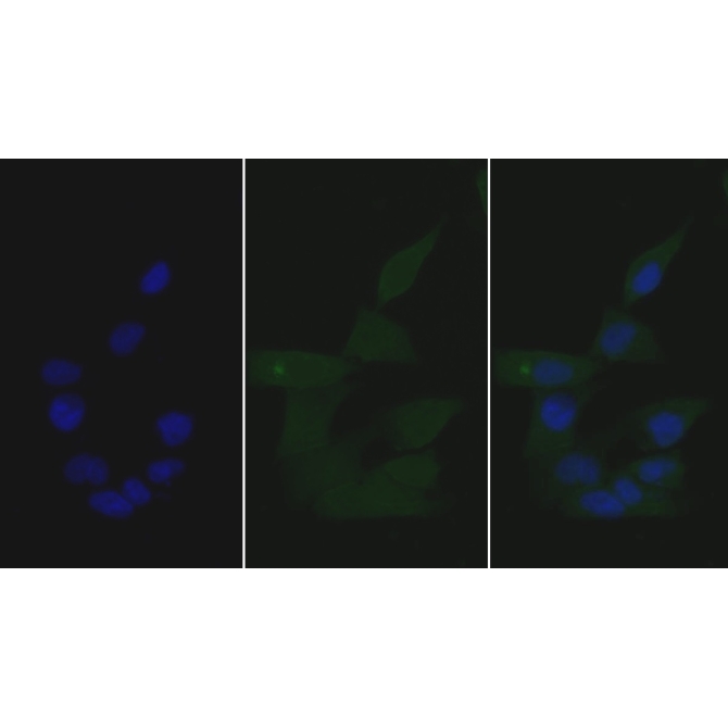 Growth Differentiation Factor 15 (GDF15) Human Monoclonal Antibody