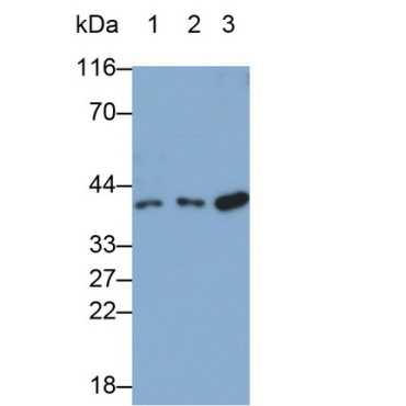 Growth Differentiation Factor 15 (GDF15) Human Monoclonal Antibody