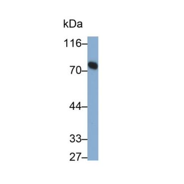 Transferrin (TF) Human Monoclonal Antibody