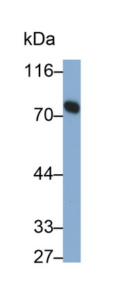 Transferrin (TF) Human Monoclonal Antibody