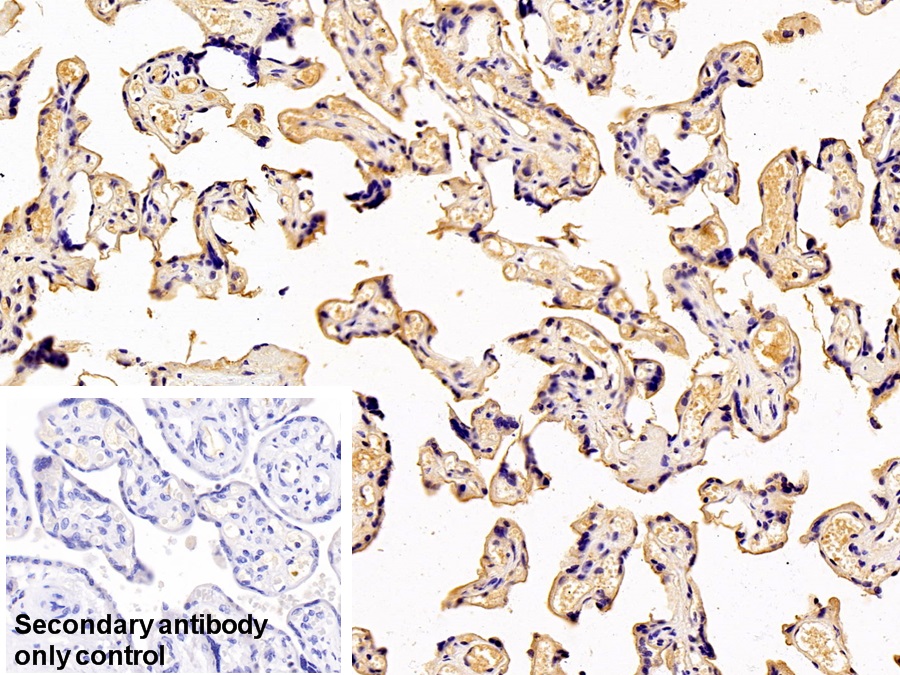 Transferrin (TF) Human Monoclonal Antibody