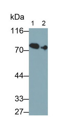 Transferrin (TF) Human Monoclonal Antibody