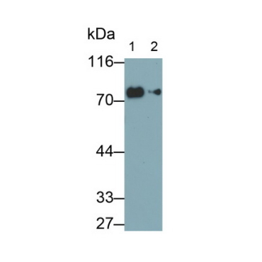 Transferrin (TF) Human Monoclonal Antibody