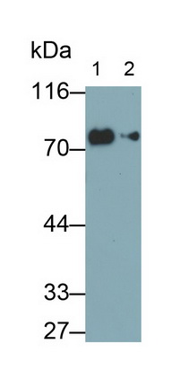 Transferrin (TF) Human Monoclonal Antibody