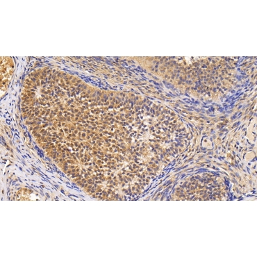 Survivin (Surv) Human Monoclonal Antibody