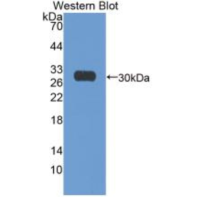 Ki-67 Protein (Ki-67) Human Monoclonal Antibody