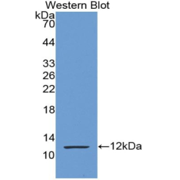 S100 Calcium Binding Protein P (S100P) Human Monoclonal Antibody