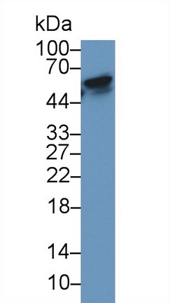 Receptor Activator Of Nuclear Factor Kappa B (RANk) Human Monoclonal Antibody