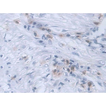 Receptor Activator Of Nuclear Factor Kappa B (RANk) Human Monoclonal Antibody