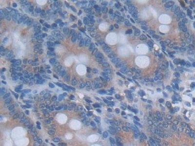Interleukin 24 (IL24) Rat Monoclonal Antibody