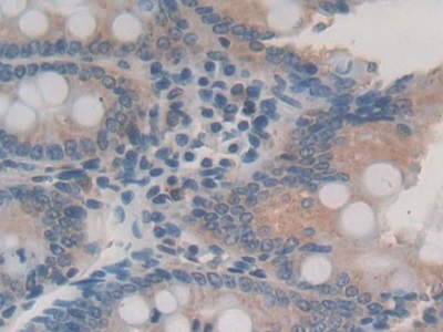 Interleukin 24 (IL24) Rat Monoclonal Antibody