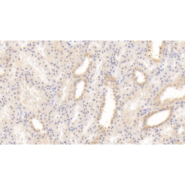 Laminin Alpha 3 (LAMa3) Human Monoclonal Antibody