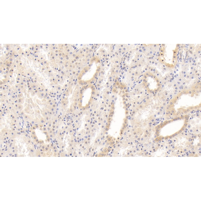 Laminin Alpha 3 (LAMa3) Human Monoclonal Antibody