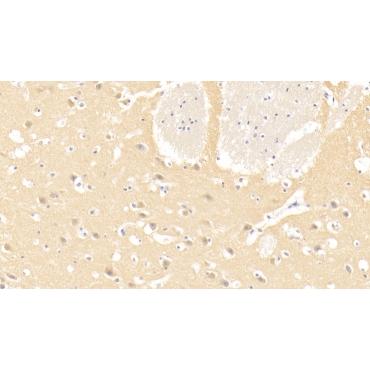 Laminin Alpha 3 (LAMa3) Human Monoclonal Antibody
