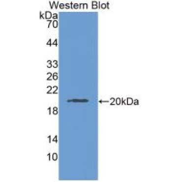 Laminin Gamma 3 (LAMC3) Mouse Monoclonal Antibody