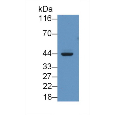 Major Histocompatibility Complex Class I C (MHCC) Human Monoclonal Antibody