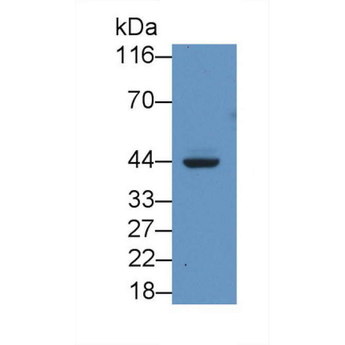 Major Histocompatibility Complex Class I C (MHCC) Human Monoclonal Antibody