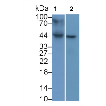 Major Histocompatibility Complex Class I B (MHCB) Human Monoclonal Antibody