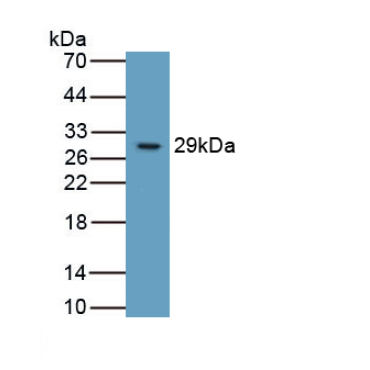 Integrin Beta 6 (ITGb6) Human Monoclonal Antibody