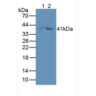 Growth Differentiation Factor 3 (GDF3) Human Monoclonal Antibody