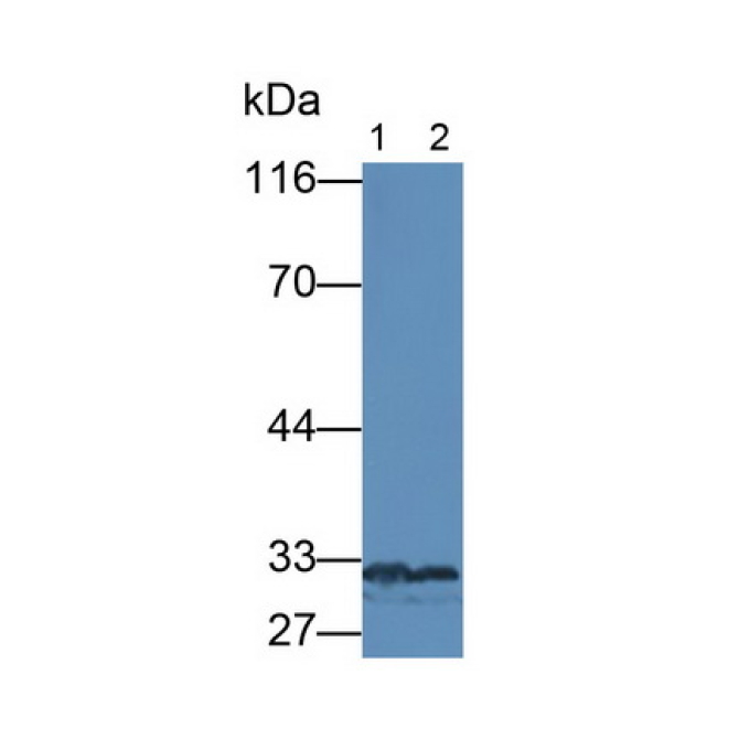 Growth Differentiation Factor 11 (GDF11) Human Monoclonal Antibody